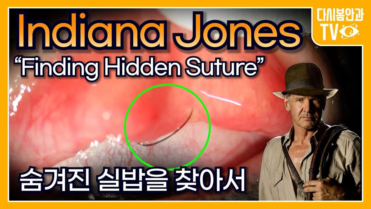 youtube-thumbnail