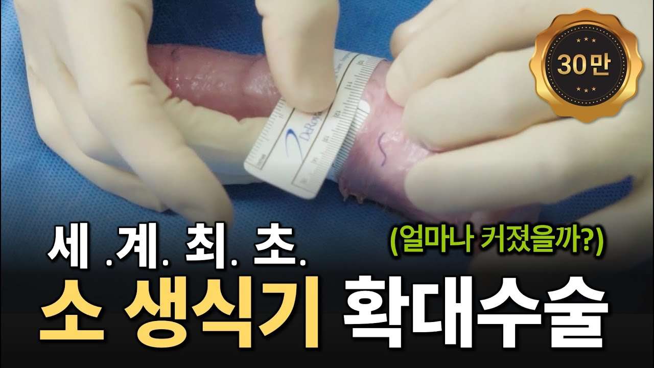 youtube-thumbnail