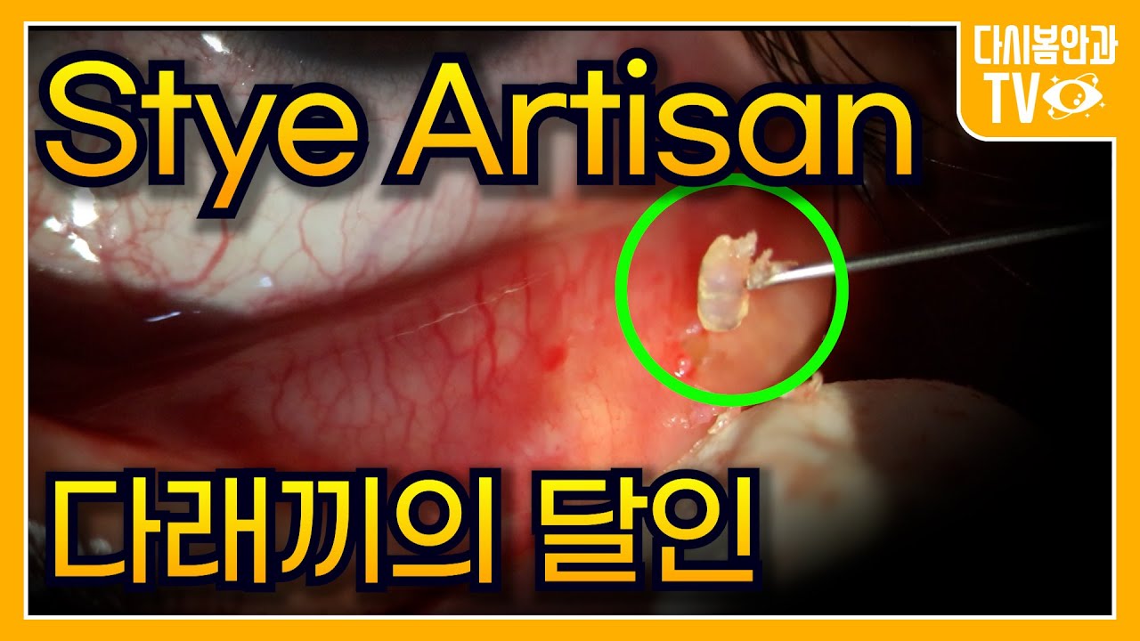 youtube-thumbnail