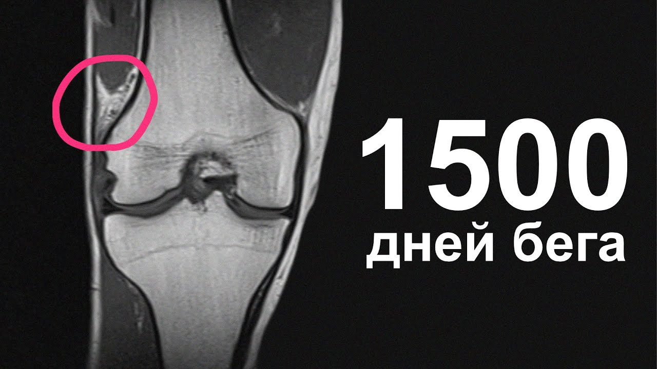 youtube-thumbnail