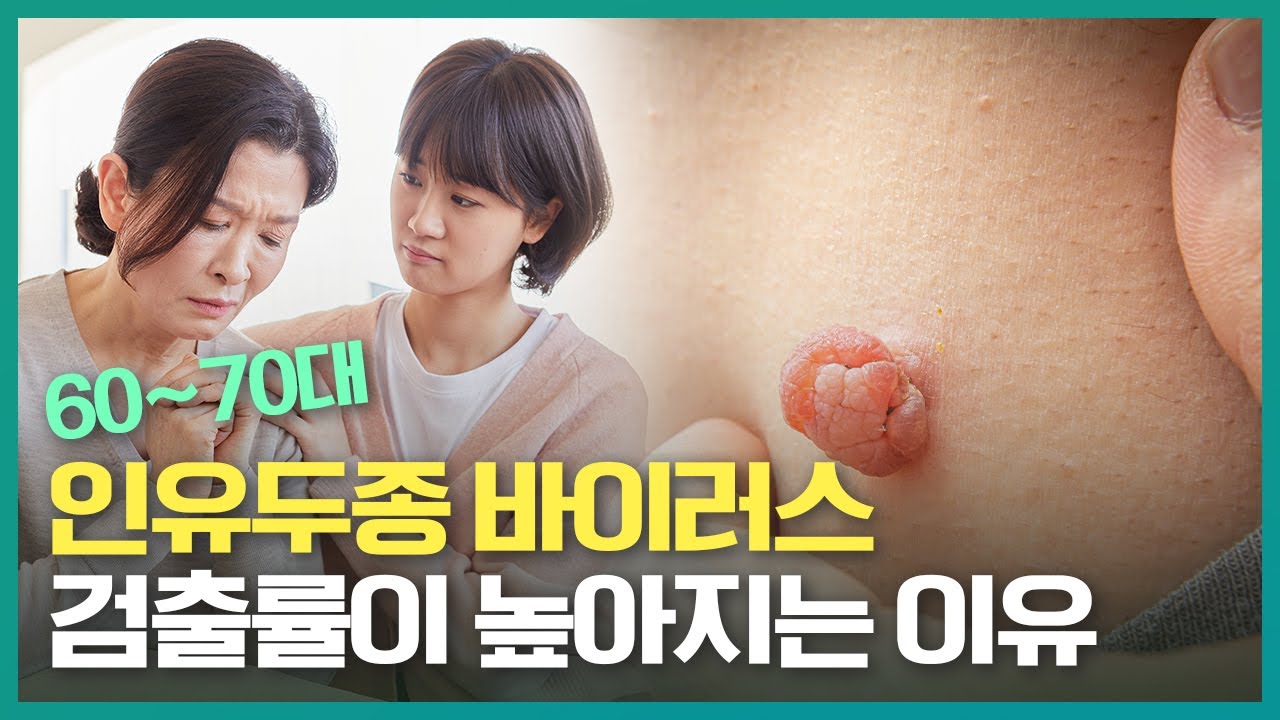 youtube-thumbnail