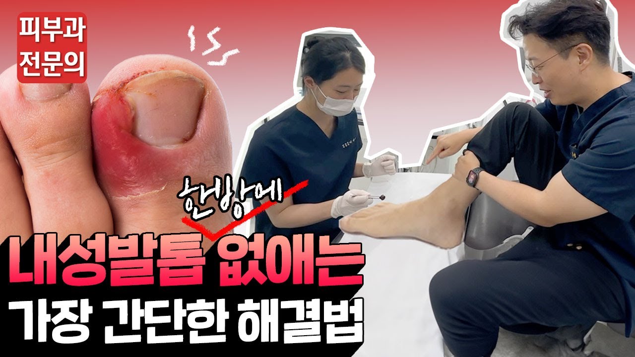 youtube-thumbnail