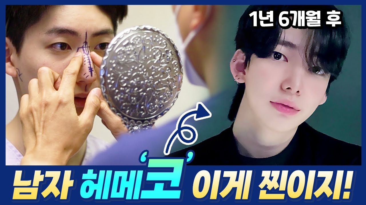 youtube-thumbnail