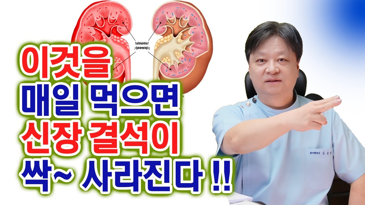 youtube-thumbnail