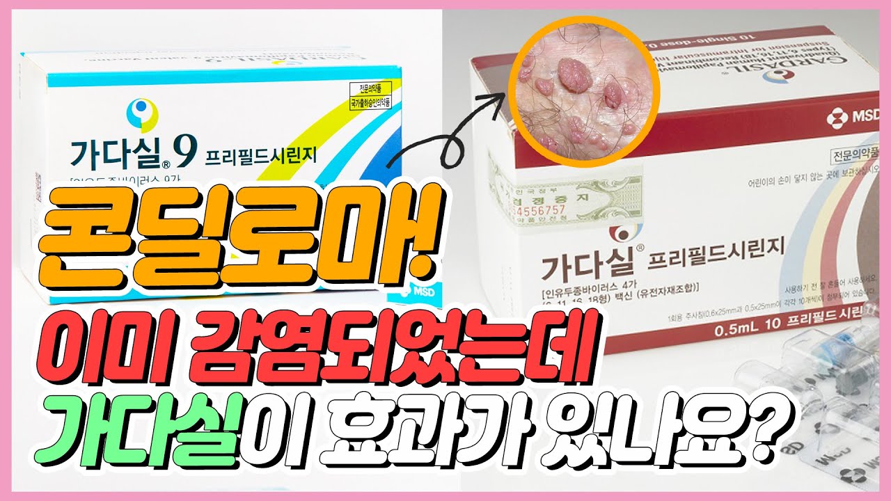 youtube-thumbnail