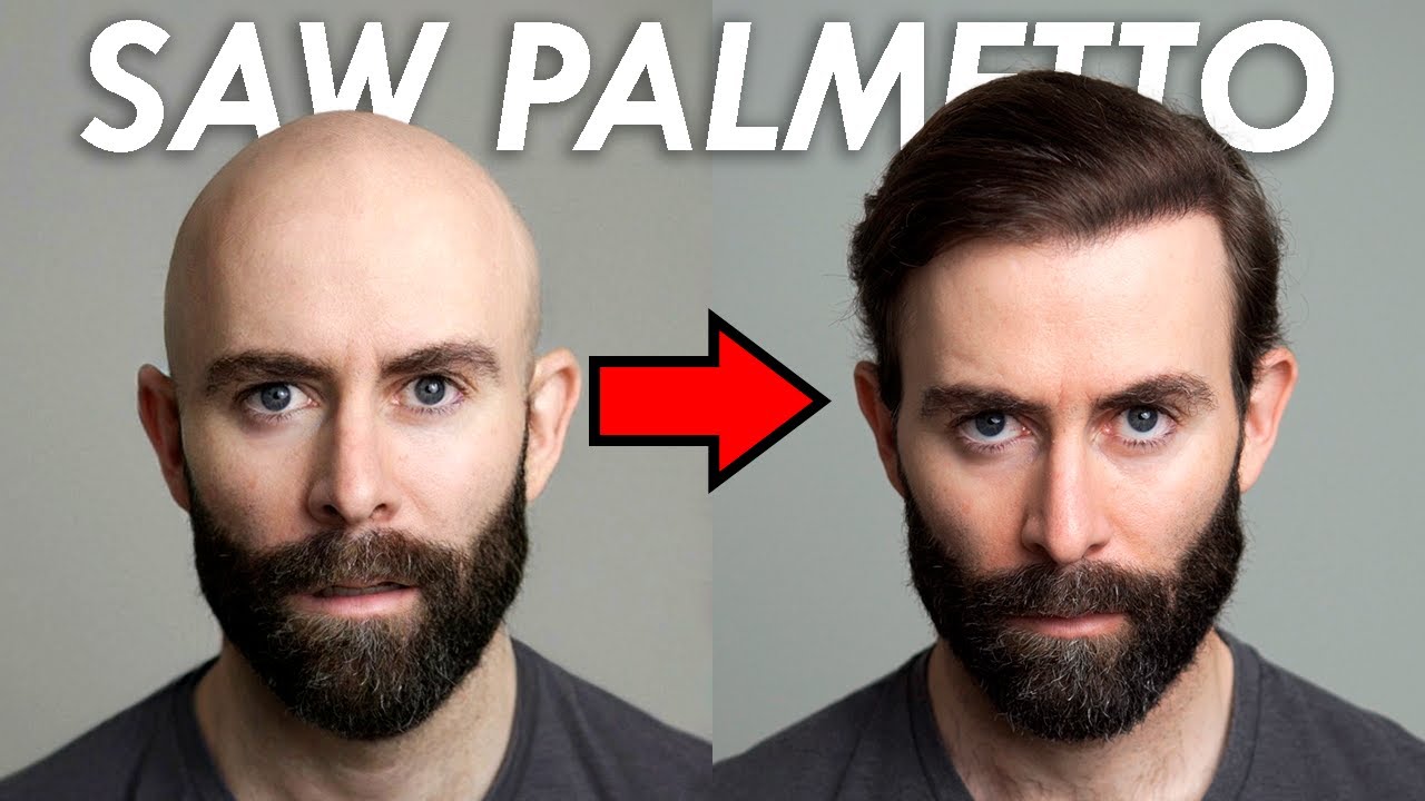 youtube-thumbnail