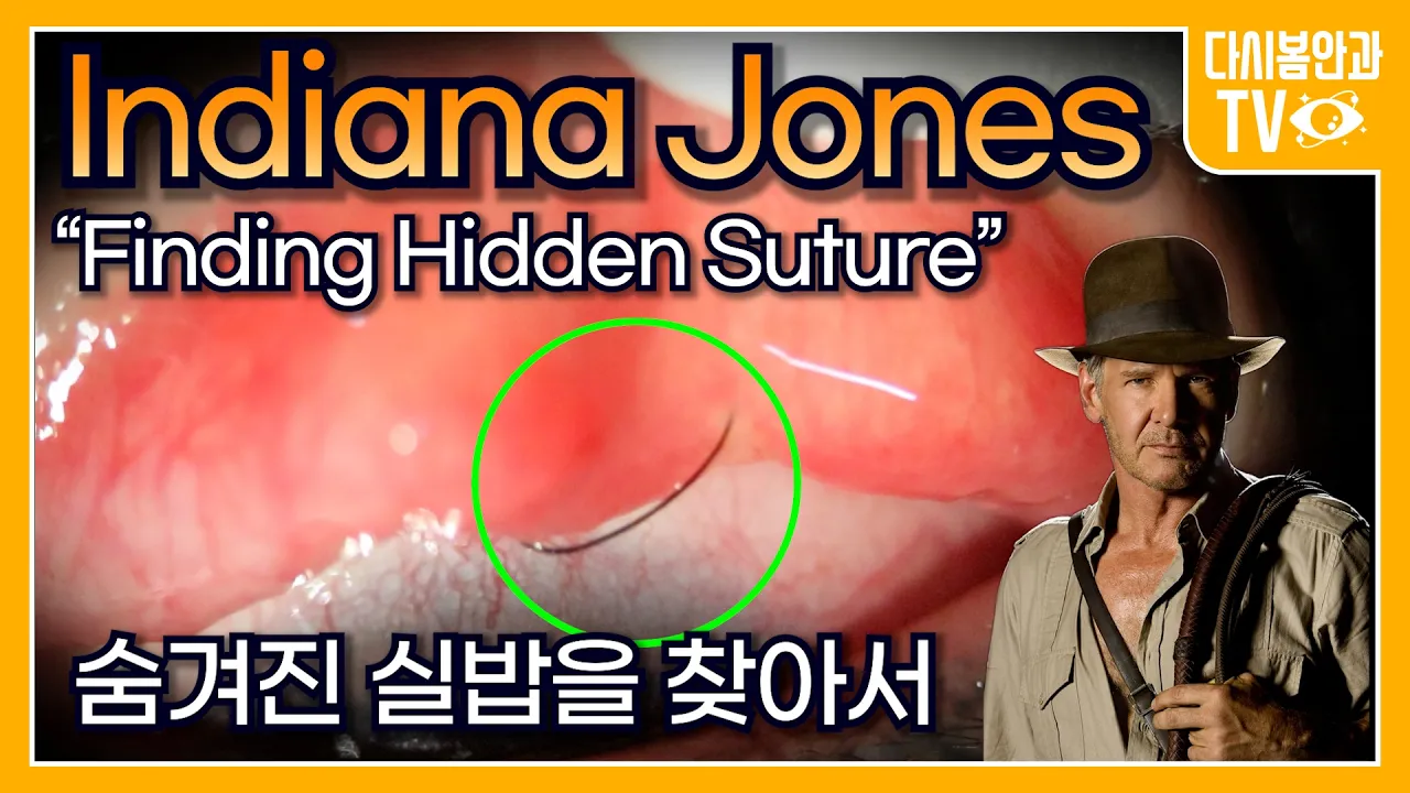 youtube-thumbnail