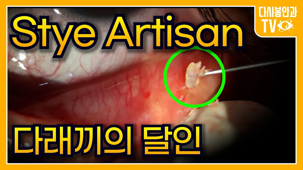 youtube-thumbnail
