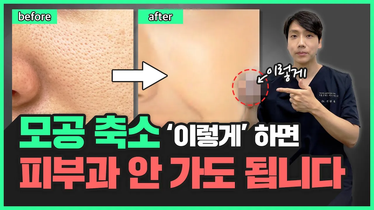 youtube-thumbnail
