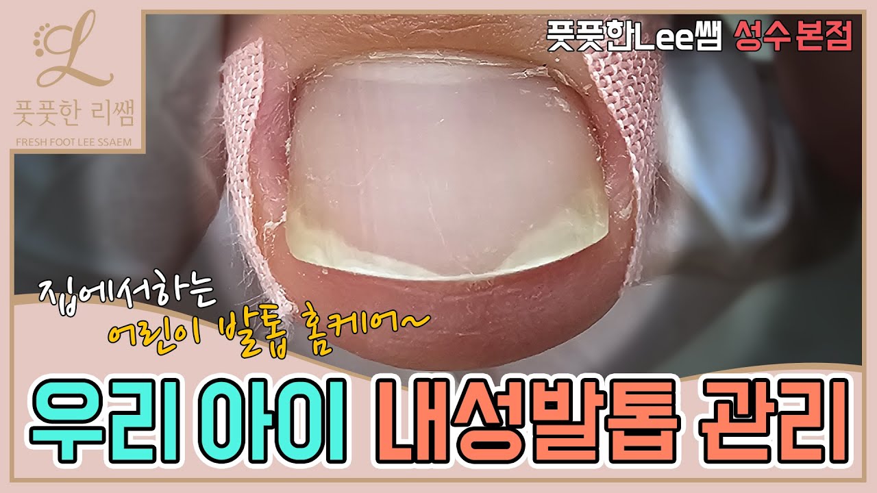 youtube-thumbnail